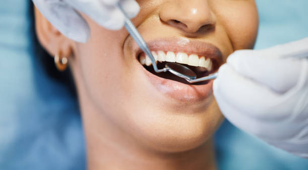 Best Emergency Dental Care for Abscessed Tooth in Fuller Heights, FL